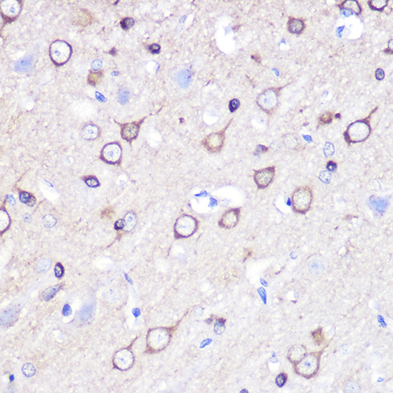 Stathmin 1 Rabbit polyclonal antibody