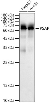 [KO Validated] PSAP Rabbit polyclonal antibody