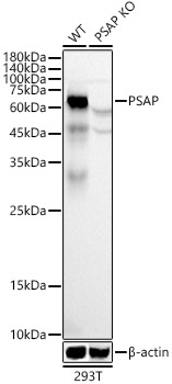 [KO Validated] PSAP Rabbit polyclonal antibody