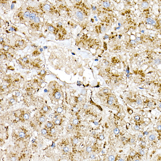 [KO Validated] PSAP Rabbit polyclonal antibody