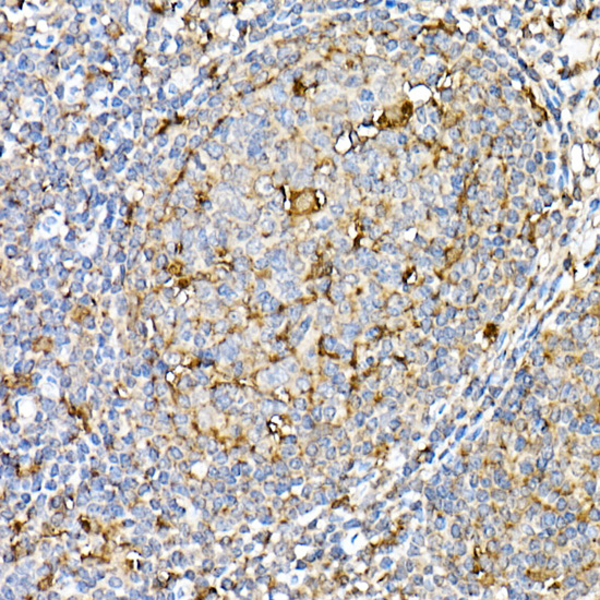 [KO Validated] PSAP Rabbit polyclonal antibody