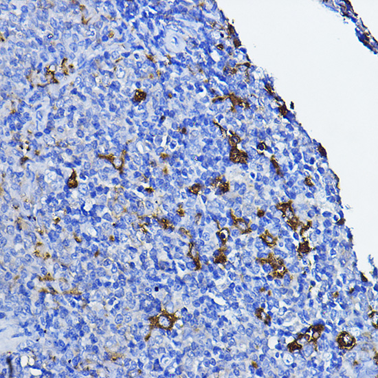 LCK Rabbit polyclonal antibody