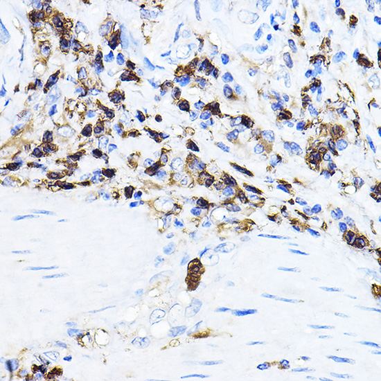 LCK Rabbit polyclonal antibody