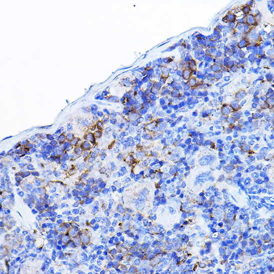 LCK Rabbit polyclonal antibody
