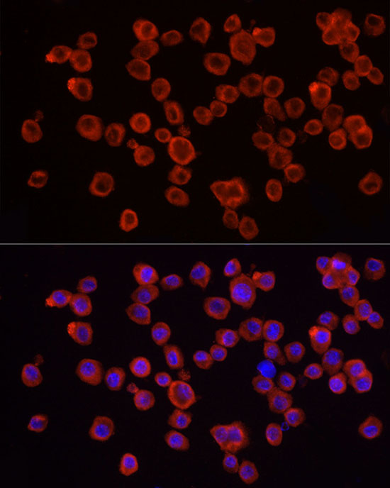 IRAK4 Rabbit polyclonal antibody