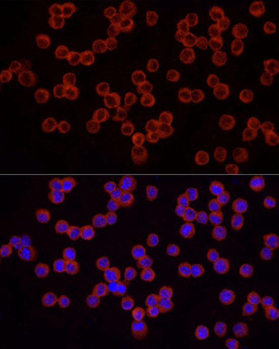 IRAK4 Rabbit polyclonal antibody