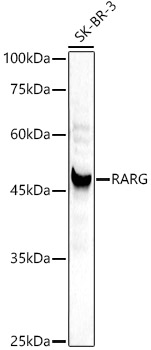 [KD Validated] RARG Rabbit polyclonal antibody