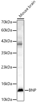 BNP Rabbit polyclonal antibody