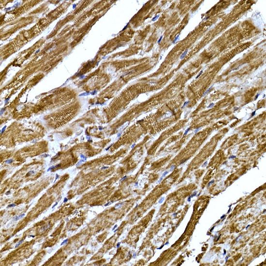 BNP Rabbit polyclonal antibody