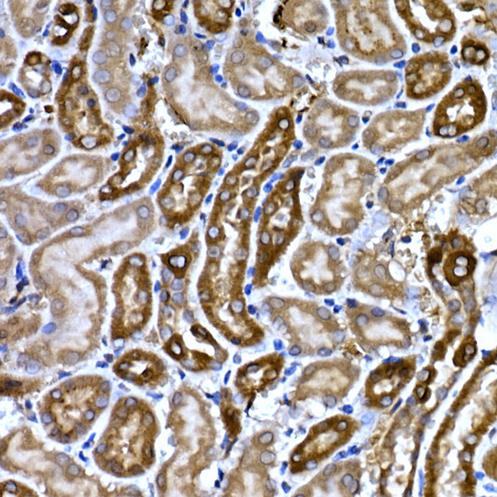 BNP Rabbit polyclonal antibody