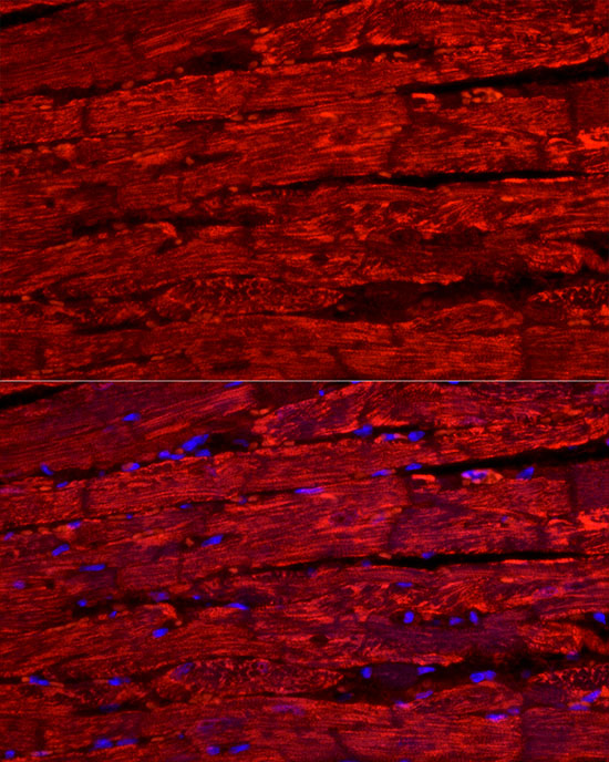 BNP Rabbit polyclonal antibody