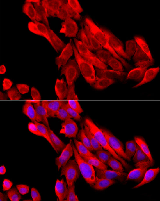 BNP Rabbit polyclonal antibody