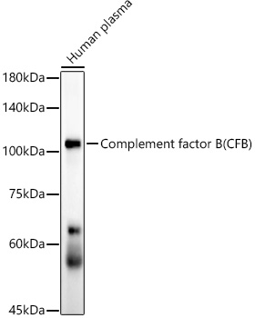 Complement factor B (CFB) Rabbit monoclonal antibody