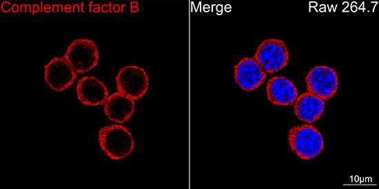 Complement factor B (CFB) Rabbit monoclonal antibody