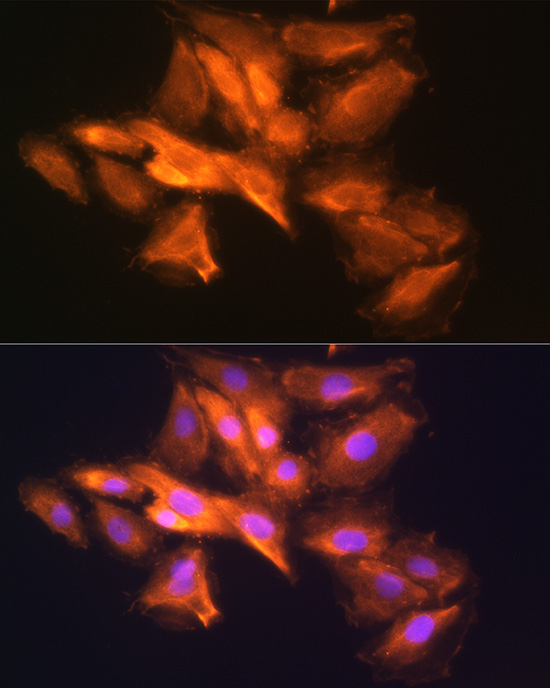 HINT1 Rabbit polyclonal antibody