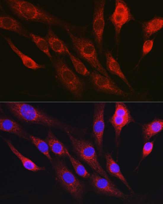 RhoC Rabbit polyclonal antibody