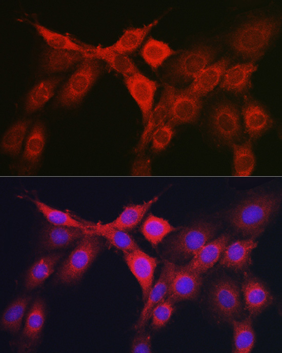 RhoC Rabbit polyclonal antibody