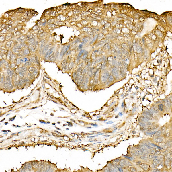 Hsp90B Beta Rabbit polyclonal antibody