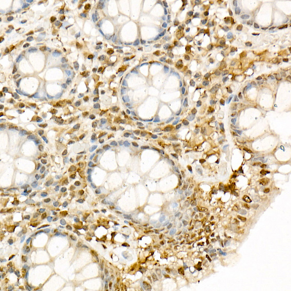 Hsp90B Beta Rabbit polyclonal antibody