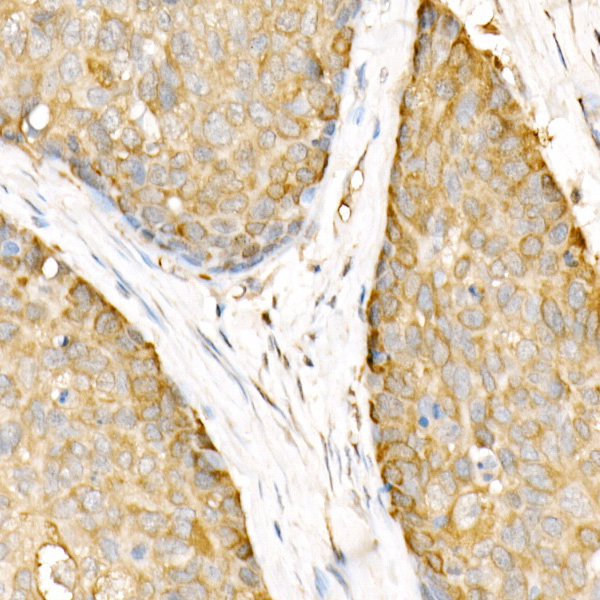 Hsp90B Beta Rabbit polyclonal antibody