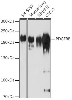 PDGFRB Rabbit polyclonal antibody