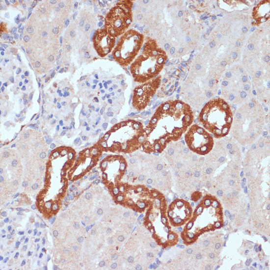 PDGFRB Rabbit polyclonal antibody