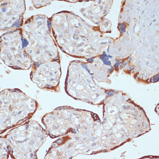 PDGFRB Rabbit polyclonal antibody