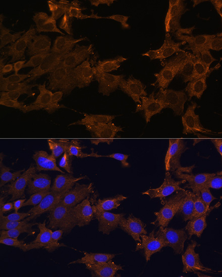 PDGFRB Rabbit polyclonal antibody