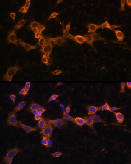 PDGFRB Rabbit polyclonal antibody
