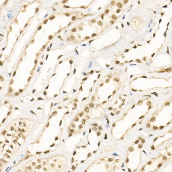 KDM1A Rabbit polyclonal antibody