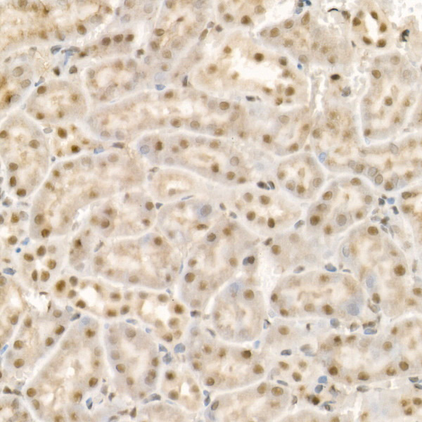 KDM1A Rabbit polyclonal antibody