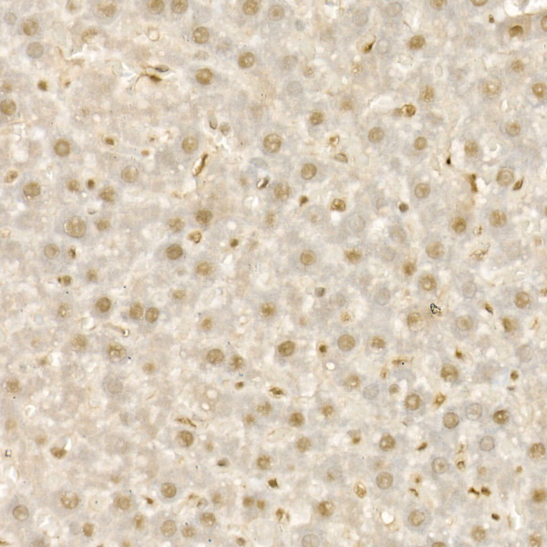 KDM1A Rabbit polyclonal antibody