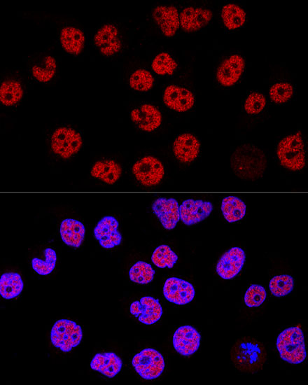 KDM1A Rabbit polyclonal antibody