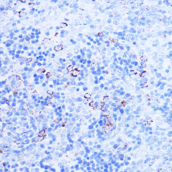 SHMT2 Rabbit polyclonal antibody