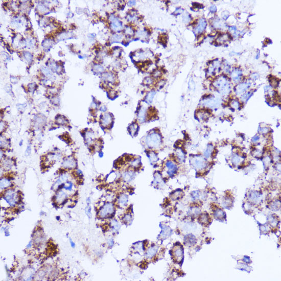 SHMT2 Rabbit polyclonal antibody