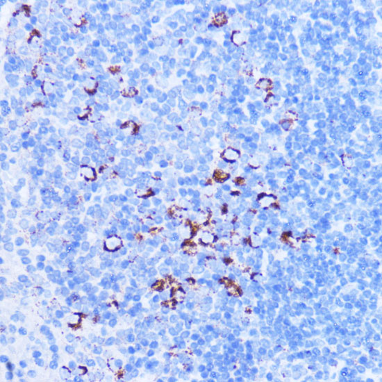 SHMT2 Rabbit polyclonal antibody