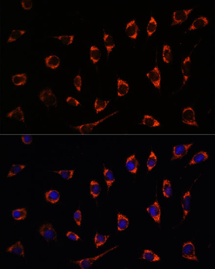 SHMT2 Rabbit polyclonal antibody