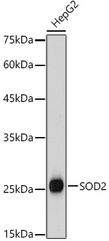 SOD2 Rabbit polyclonal antibody