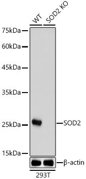 SOD2 Rabbit polyclonal antibody