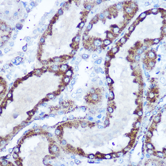 SOD2 Rabbit polyclonal antibody