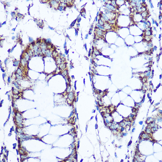SOD2 Rabbit polyclonal antibody