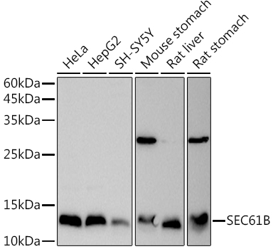 SEC61B Rabbit polyclonal antibody