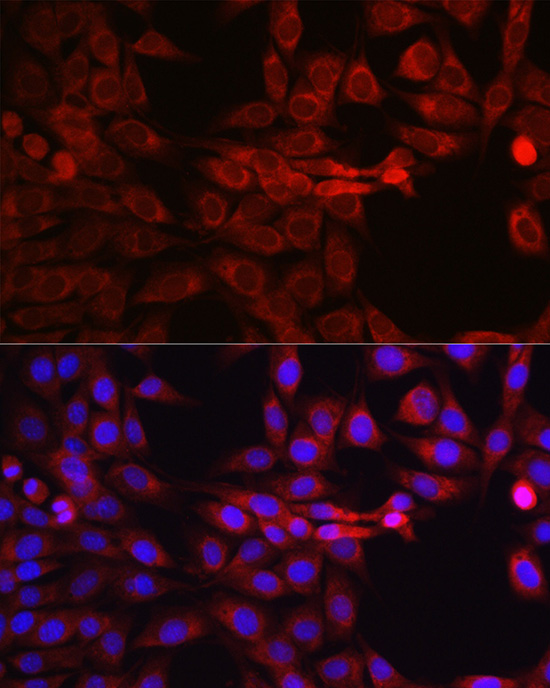 SEC61B Rabbit polyclonal antibody