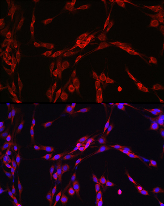 SEC61B Rabbit polyclonal antibody