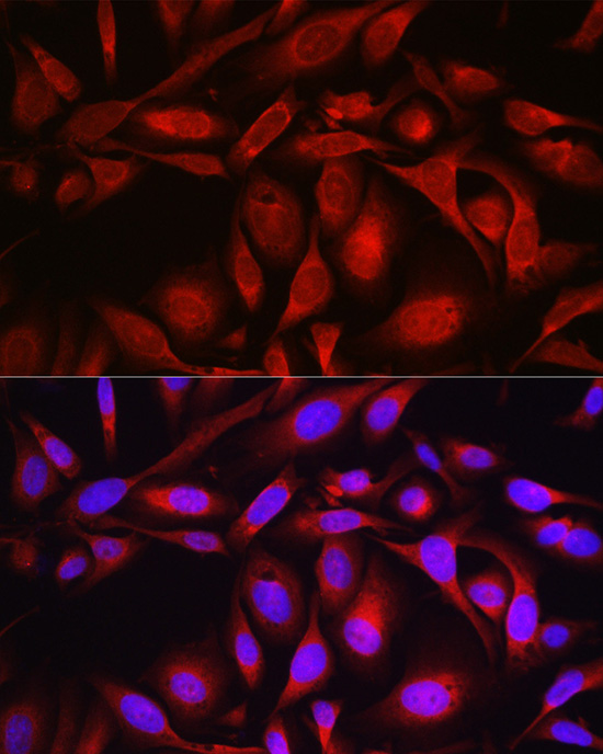 SEC61B Rabbit polyclonal antibody