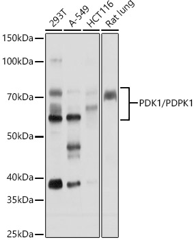 PDK1/PDPK1 Rabbit pAb