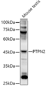 PTPN2 Rabbit polyclonal antibody