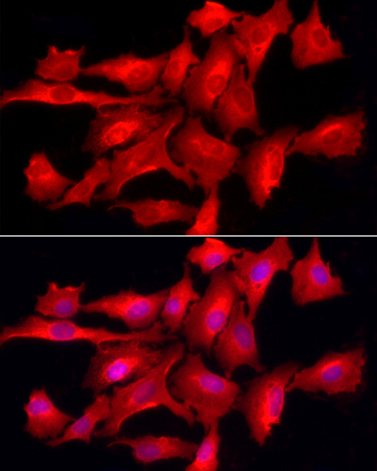 PTPN2 Rabbit polyclonal antibody