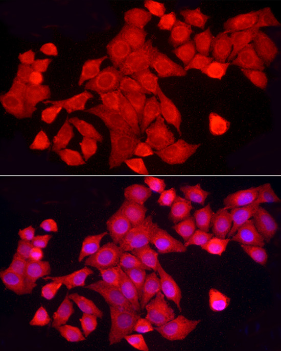PTPN2 Rabbit polyclonal antibody