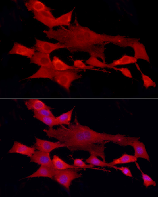 PTPN2 Rabbit polyclonal antibody